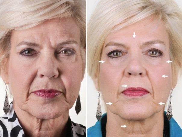 Extra Beauty kollagén és hyaluronsav, kovaföld kapszula Extra Beauty kollagén és hyaluronsav kapszula HATÁSA